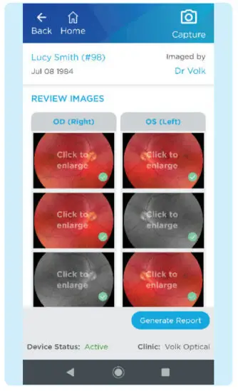 VOLK VISTA VIEW Handheld Retinal Camera - GENERATING A REPORT 1