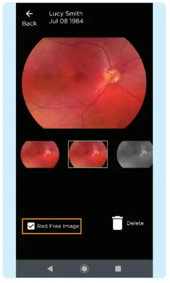 VOLK VISTA VIEW Handheld Retinal Camera - GENERATING A REPORT 2