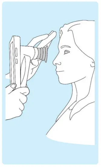 VOLK VISTA VIEW Handheld Retinal Camera - IMAGING 10