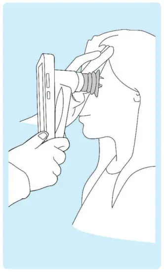 VOLK VISTA VIEW Handheld Retinal Camera - IMAGING 11