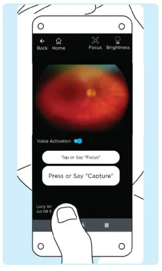 VOLK VISTA VIEW Handheld Retinal Camera - IMAGING 13