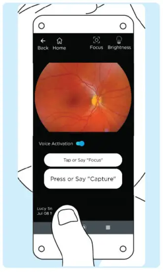 VOLK VISTA VIEW Handheld Retinal Camera - IMAGING 15