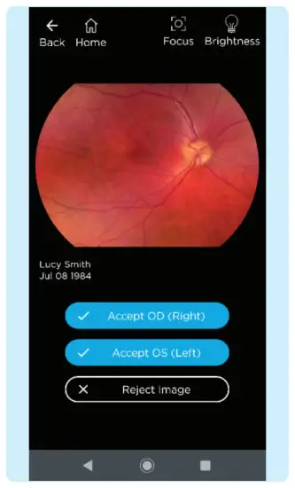VOLK VISTA VIEW Handheld Retinal Camera - IMAGING 16