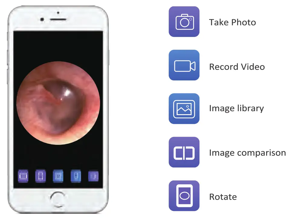 TESLONG SA39W Digital Ear Camera Wi Fi Otoscop - fig 6