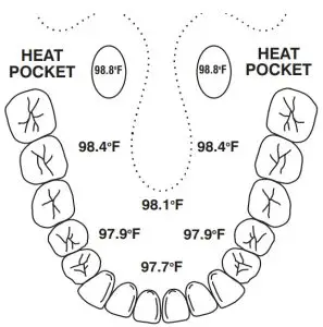 ORAL TEMPERATURE