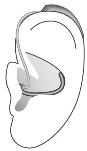 Removing a hearing instrument