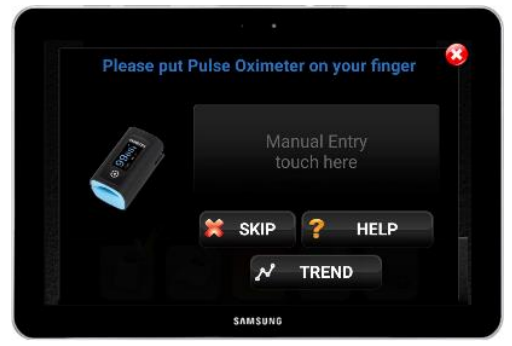 Vivify health PC-60FW Pulse Oximeter -- Record1