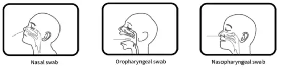 Sungo global services HRK-6620 SARS-CoV-2 Antigen Rapid Test Kit-1