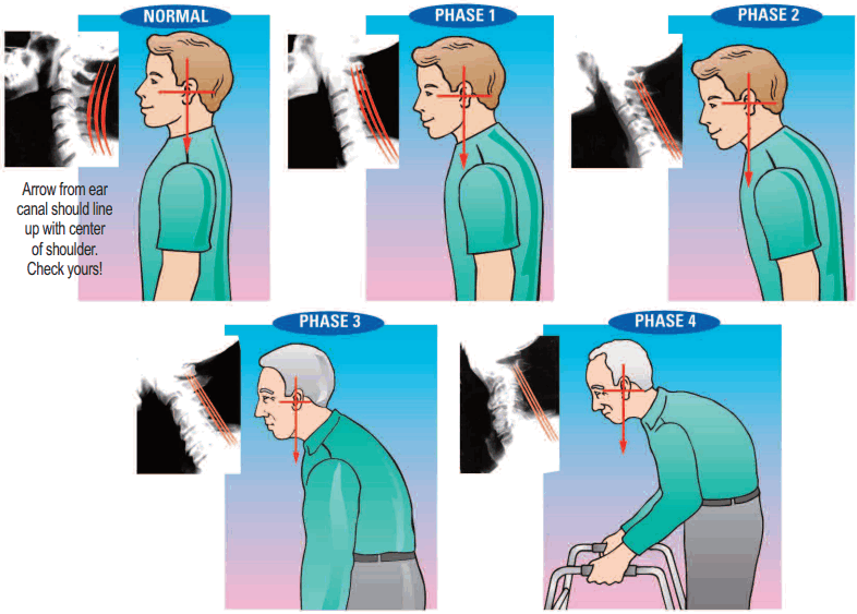 POSTURE PUMP 1400D Dual Disc Hydrator