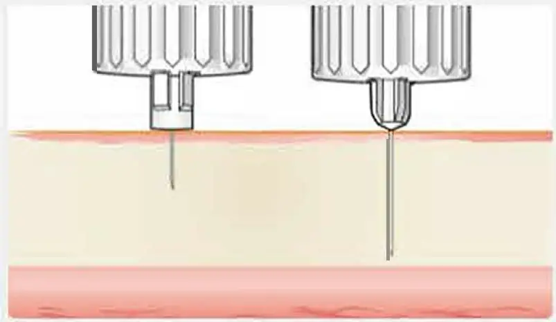 novo-nordisk-185255-NovoFine-Pen-Needle-fig-5