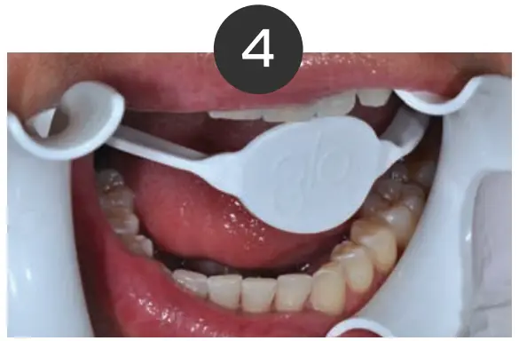 Whitening Instructions