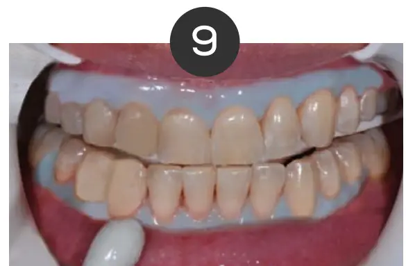 Whitening Instructions