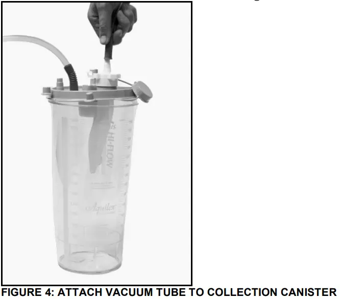 stryker Reprocessed MyoSure REACH Tissue Removal Device - FIGURE 4