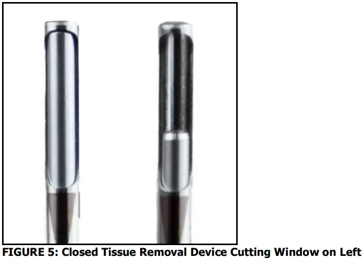stryker Reprocessed MyoSure REACH Tissue Removal Device - FIGURE 5