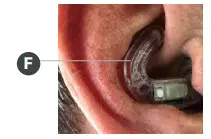 Tetra AlphaShield Series Hearing Devices for Hunting - INSERTION