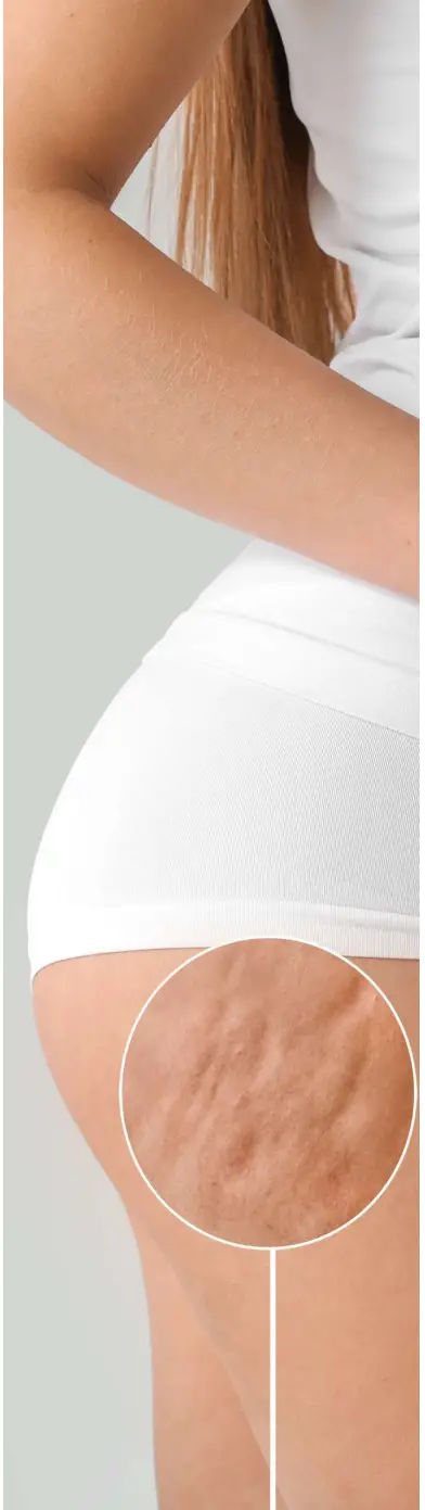 manicare 23118 Firming Body Sculptor - body 1