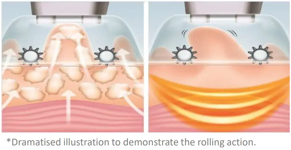 manicare 23118 Firming Body Sculptor - rolling action