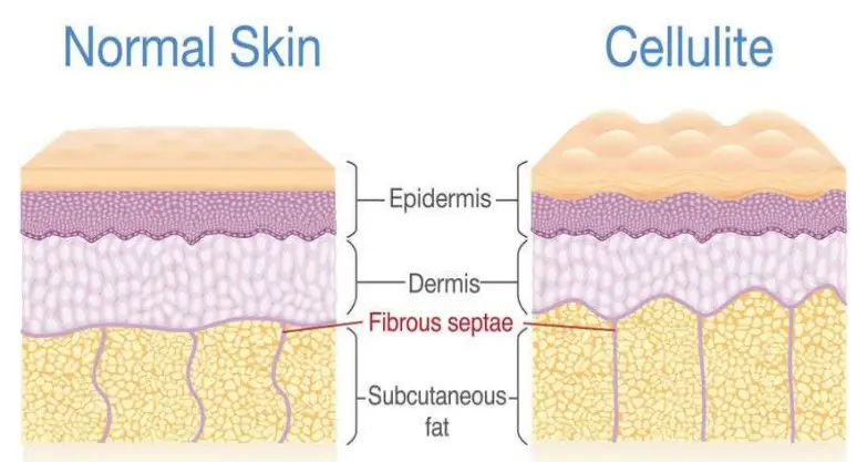 manicare 23118 Firming Body Sculptor - stomach