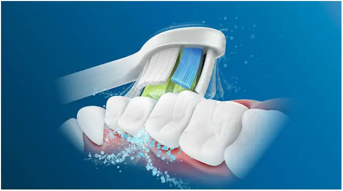 PHILIPS HX622155 Sonic Electric Toothbrush - technology