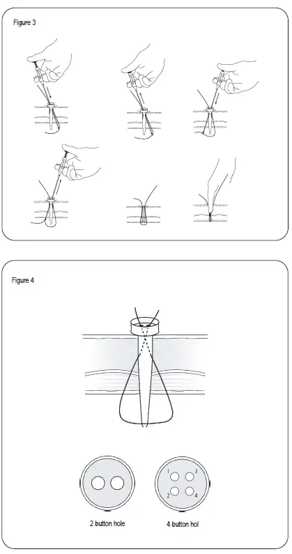 Symmetry Surgical RSG-14F Suture PassOR PRO 2