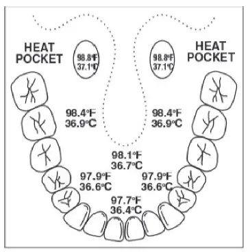 MABIS 9-Second Flexible Tip Digital Thermometer fig (3)