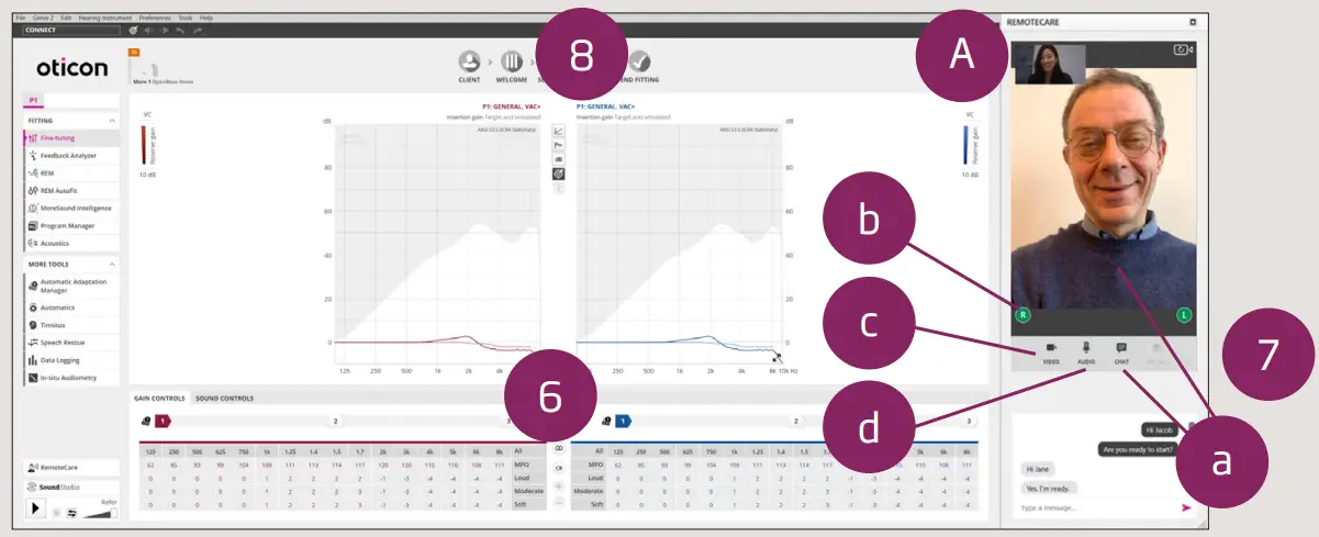 OTICON RemoteCare App-Connection Bar1
