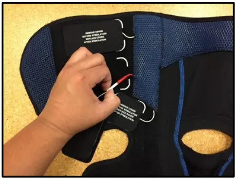 CyMedica-QB1-Electrode-Placement-fig-11