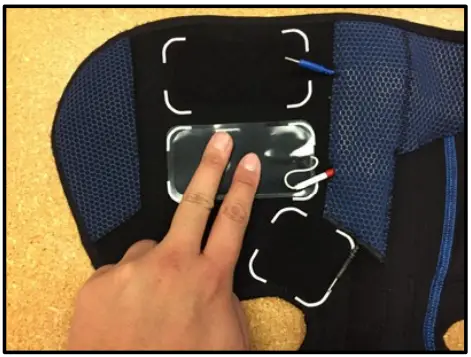 CyMedica-QB1-Electrode-Placement-fig-5