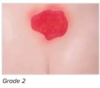 3B Nikki The Nursing Manikin With Auscultation - Grade 2