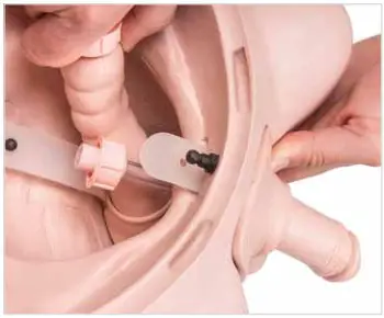 3B Nikki The Nursing Manikin With Auscultation - Installation of the Genital Insert