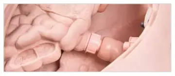 3B Nikki The Nursing Manikin With Auscultation - Installation of the Internal Organs