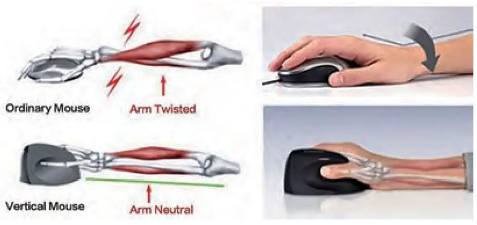 YWYT-G857-Vertical-Ergonomic-Gaming-Wireless-Mouse-2