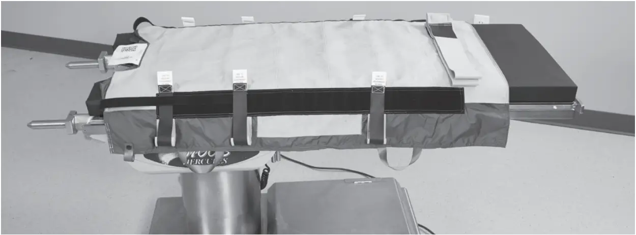 HOVERTECH T-Burg - Attaching to Operating Room Table 1