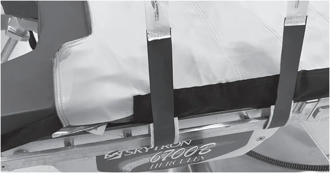 HOVERTECH T-Burg - Attaching to Operating Room Table 5