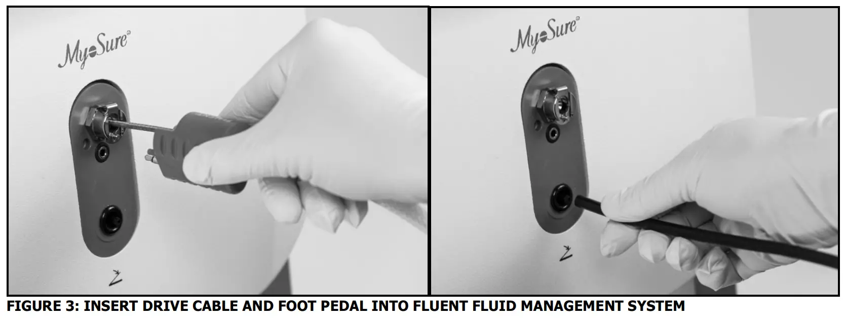Reprocessed MyoSure XL Tissue Removal Device for Fluent: 50-601XL