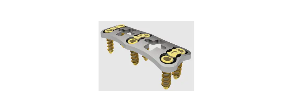 Orthofix Aw-60-9902 3˚ Anterior Cervical Plating System Instructions Orthofix Aw-60-9902 3˚ Anterior Cervical Plating System Instructions