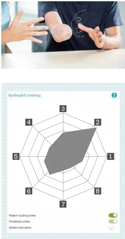 ottobock-Myo-Plus-Pattern-Recognition-fig-16