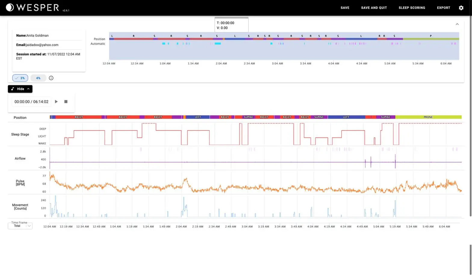 WESPER Sleep Provider Portal - SIGNALS VIEW 1