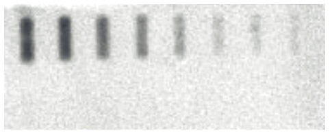 FUJIFILM FLA 5OOO Fluorescent Image Analyzer - The band at