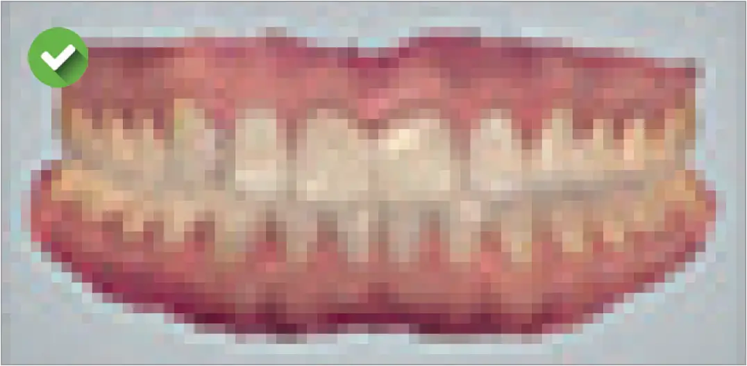 Good Scan to Order a Narval CC