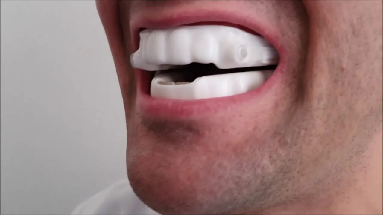 Resmed Lt-008 Narval Cc Oral Appliance User Guide