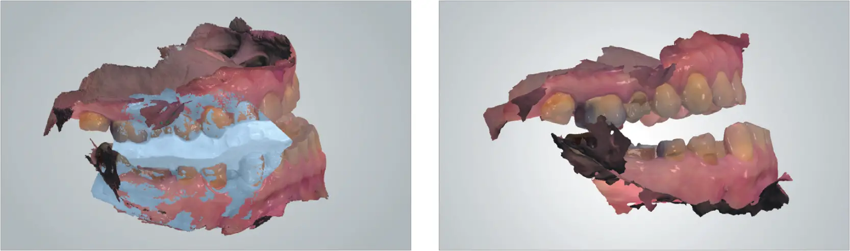 Scan in Desired Protrusion