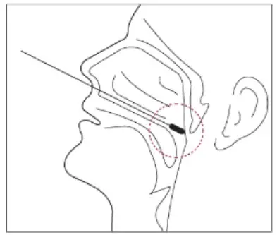 GenBody COVID-19 Ag Rapid Diagnostic - Nasopharyngeal Samples