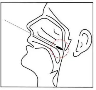 GenBody COVID-19 Ag Rapid Diagnostic - Nasopharyngeal