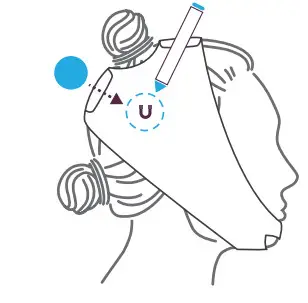 Cochlear D1938445-V3 MRI Kit - Figure 5