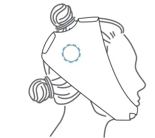 Cochlear D1938445-V3 MRI Kit - Figure 7