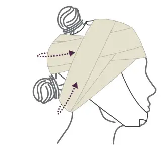 Cochlear D1938445-V3 MRI Kit - Figure 9