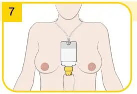 medela-SNS 009.0005-Supplemental-Nursing System-14
