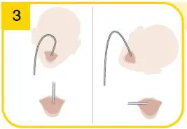 medela-SNS 009.0005-Supplemental-Nursing System-19