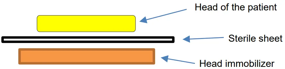 BOSCAROL Wind and OB Head Immobilizer - FIGURE 4